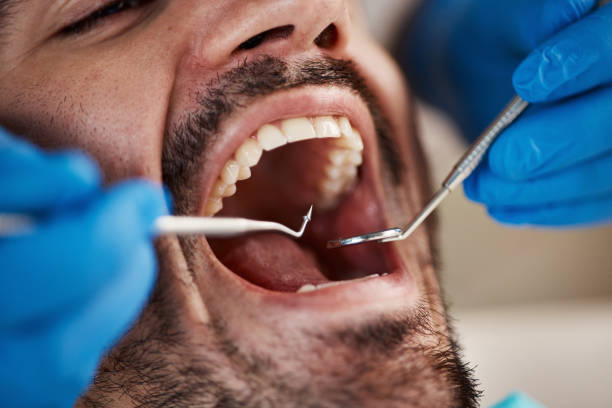Best Emergency Tooth Extraction in Edgerton, OH